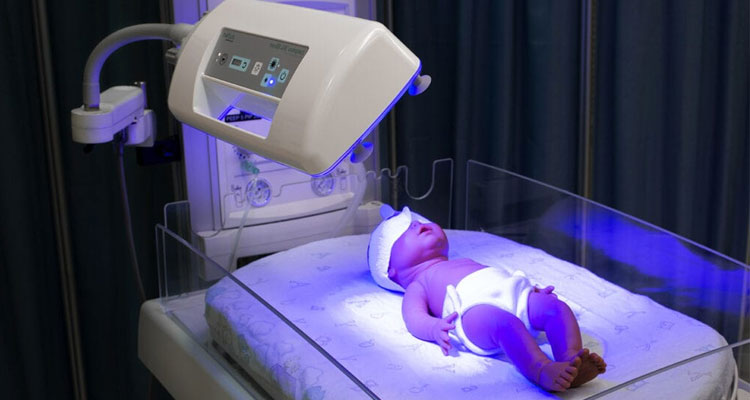 دستگاه زردی نوزاد